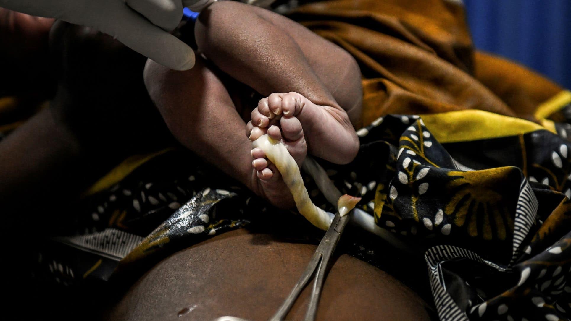 Teenage pregnancies,Africa,COVID